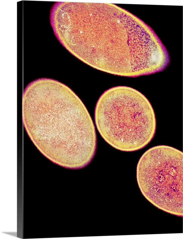 Clostridium difficile bacteria, coloured transmission electron micrograph (TEM). These Gram-positive rod-shaped bacteria c...