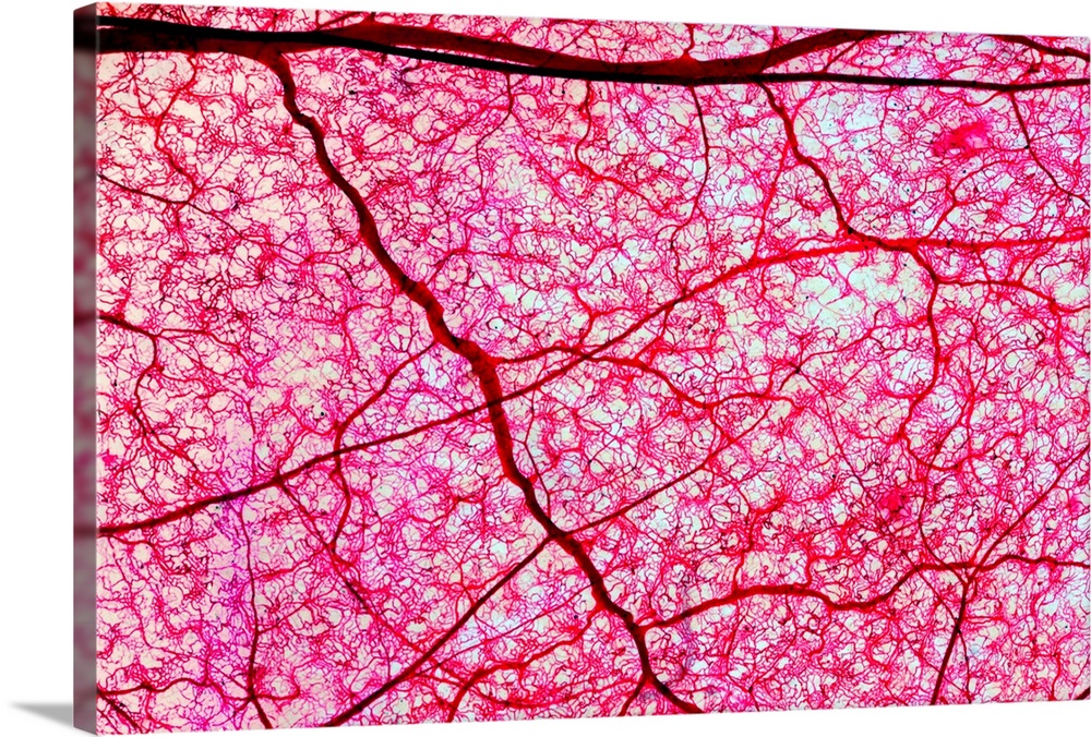 Colon blood vessels. Light micrograph of a piece of the wall of a mammalian large intestine or colon. The colon tissue has...