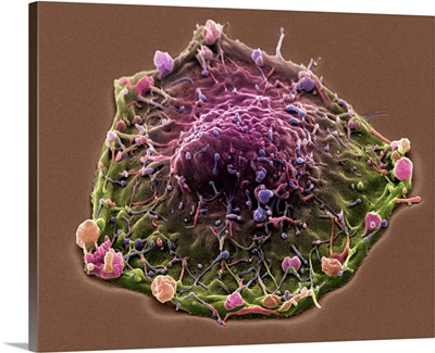 Colon cancer cell, SEM