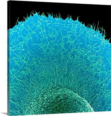 Colorectal Cancer Cell, SEM