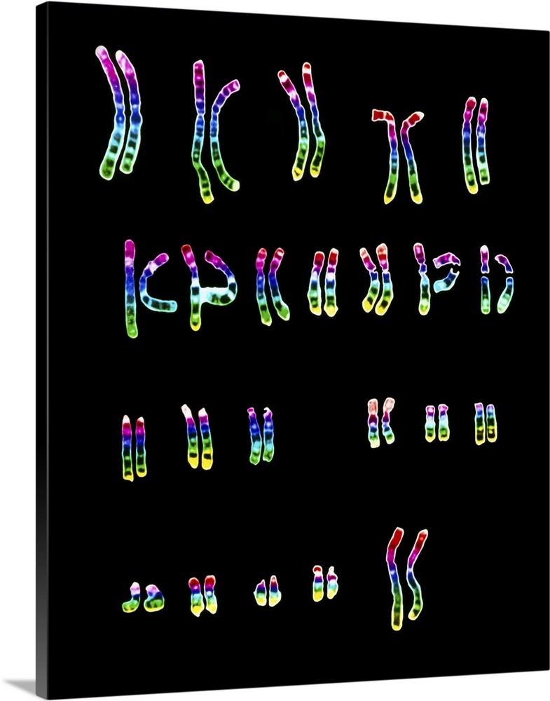 Female chromosomes. Light micrograph of a normal female karyotype, the full complement of female chromosomes arranged in n...