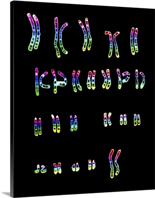 Coloured LM of a normal female karyotype