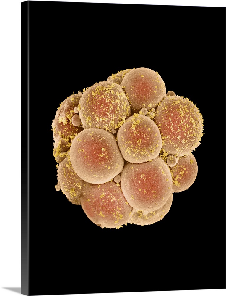 Sixteen-cell embryo. Coloured scanning electron micrograph (SEM) of a human embryo at the sixteen cell stage, four days af...