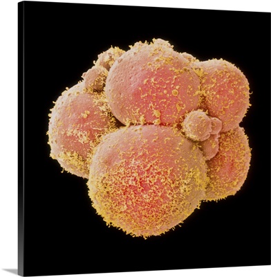 Coloured SEM of human embryo at 8-cell stage
