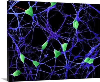 Cortical Neurons, SEM