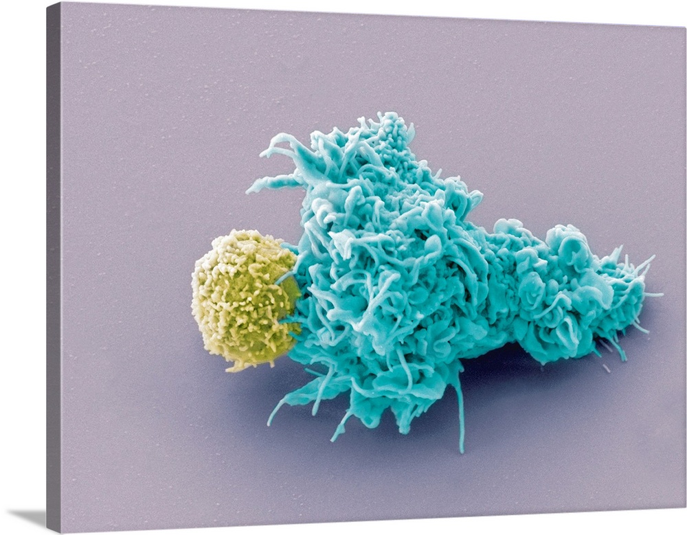 Dendritic cell and lymphocyte, coloured scanning electron micrograph (SEM). Interaction between a dendritic cell (blue) an...