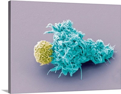 Dendritic Cell And Lymphocyte, SEM