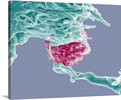 Dendritic Cell And Lymphocyte, SEM