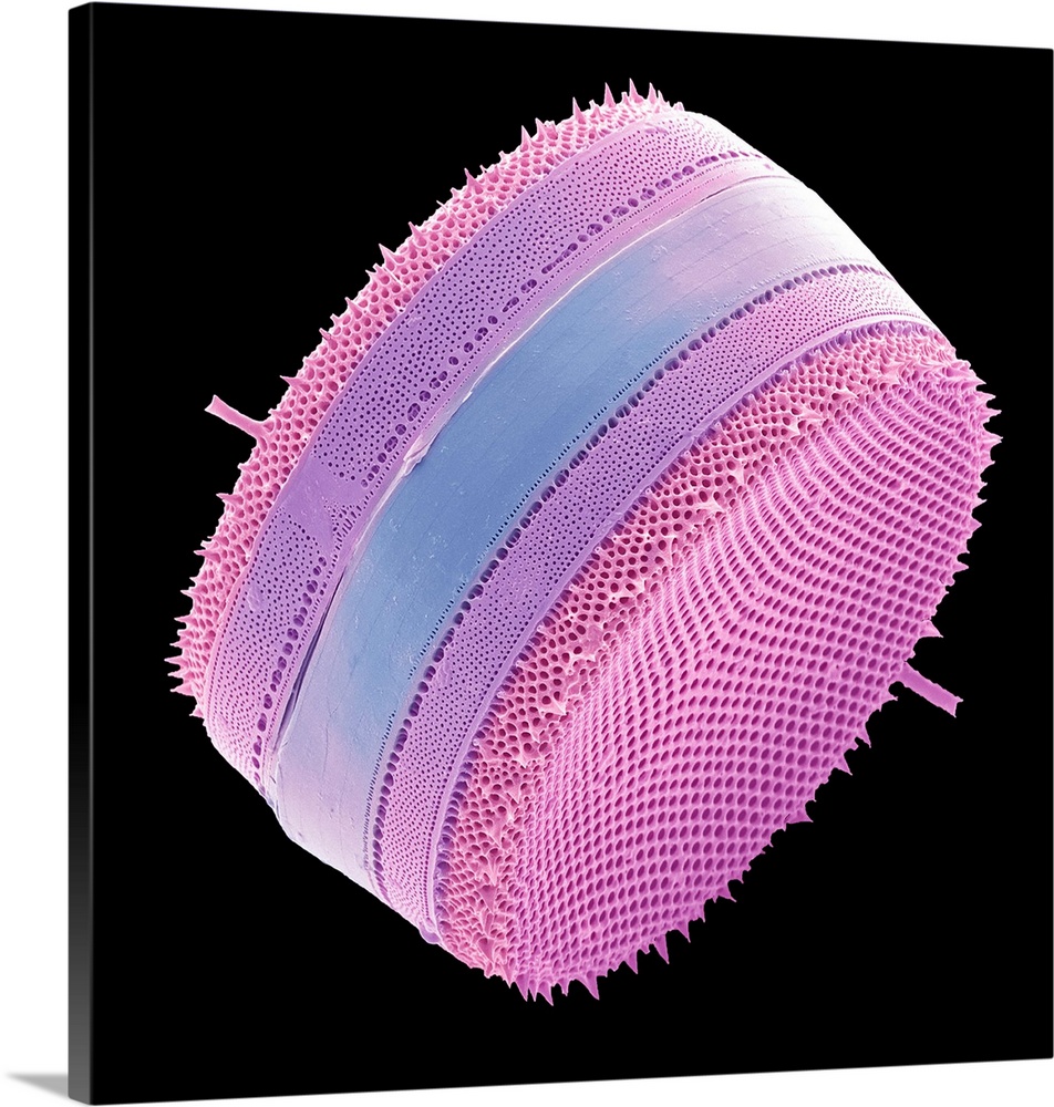 Diatom. Coloured scanning electron micrograph (SEM) of a single diatom. Diatoms may be extremely abundant in both freshwat...