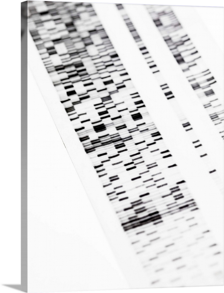 DNA autoradiogram.