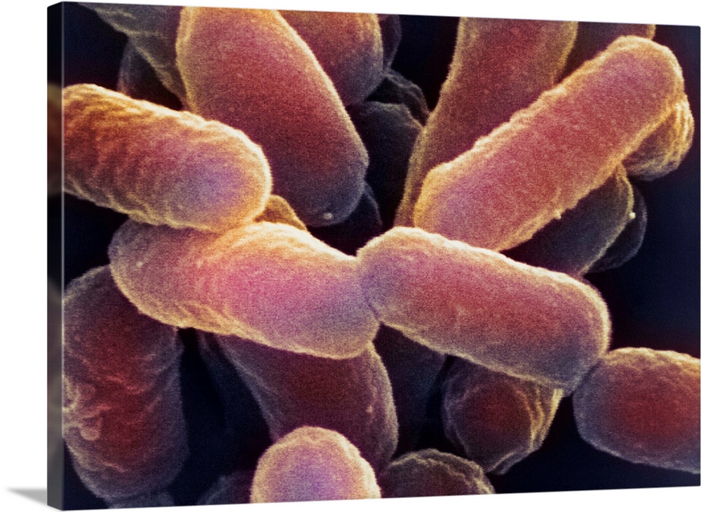 E. coli 0157:H7 bacteria. Coloured scanning electron micrograph (SEM) of Escherichia coli 0157:H7 bacteria, cause of foodb...