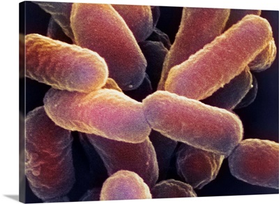 E. coli 0157:H7 bacteria