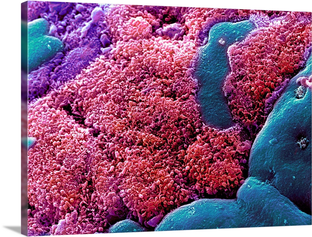 E. coli bacteria. Coloured scanning electron micrograph (SEM) of Escherichia coli bacteria (red) taken from the small inte...