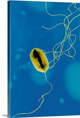 E. coli bacteria strain O157:H7, TEM