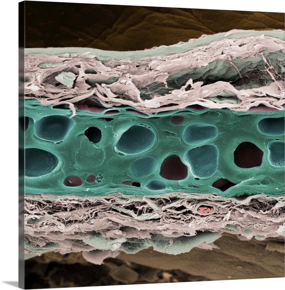 Elastic cartilage. Coloured scanning electron micrograph (SEM) of a section through elastic cartilage (green) from a pinna...