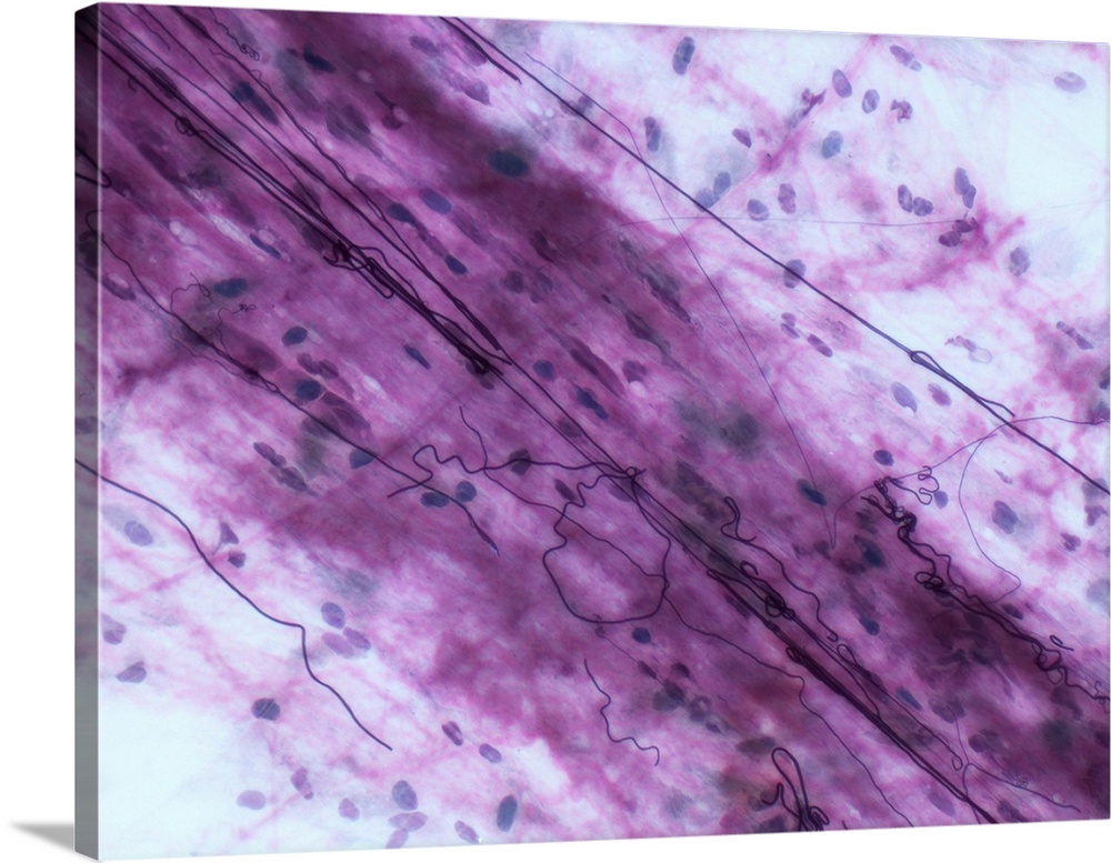 Light micrograph (LM) of loose connective tissue to show elastin fibers. Elastin fibres form a 3D network with collagen fi...
