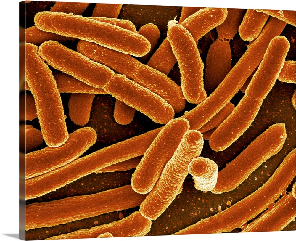 Escherichia coli bacteria, coloured scanning electron micrograph. E. coli bacteria are a normal part of the intestinal flo...