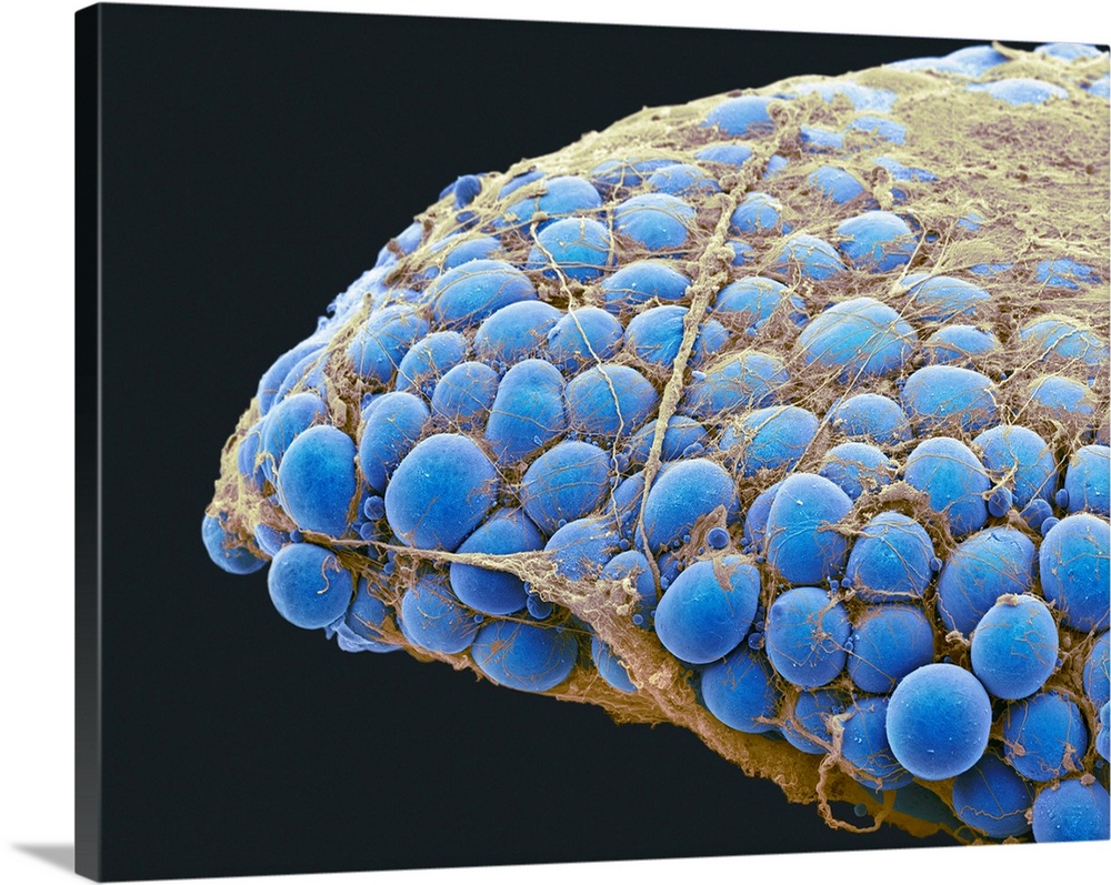 Fat tissue. Coloured scanning electron micrograph (SEM) of a sample of fat tissue, showing fat cells (adipocytes, blue) su...