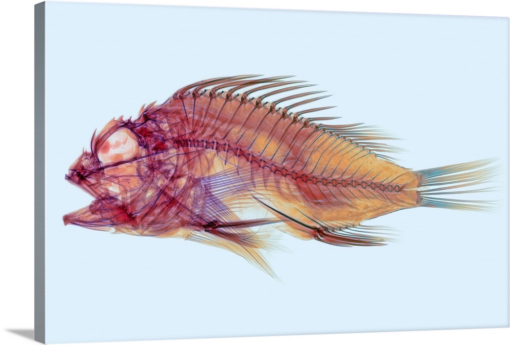 Fish, coloured X-ray. This is a type of scorpionfish (order Scorpaeniformes). Its large eye socket and strongly-rayed fins...