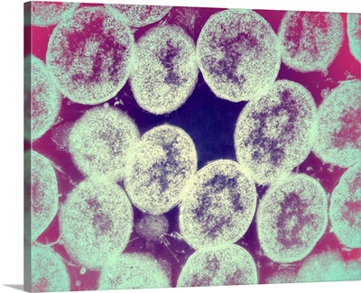 Gonorrhoea bacteria, TEM