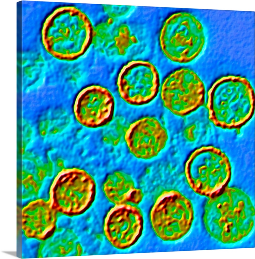 Color enhanced transmission electron micrograph (TEM) of Hantavirus particles. Hantavirus is a respiratory disease carried...