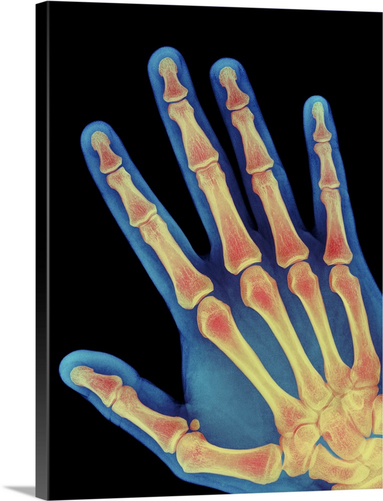 Healthy hand. Coloured X-ray of the healthy hand of a 60 year old man, showing the skeleton of bones. The fleshy outline o...