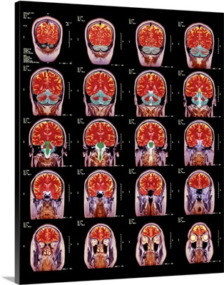 Healthy brain, MRI scans