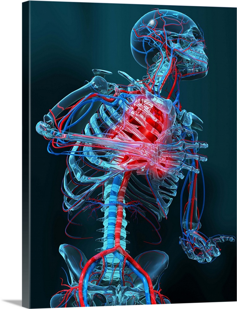 Heart attack. Computer artwork of the head and body of a human skeleton that is having a heart attack (myocardial infarcti...