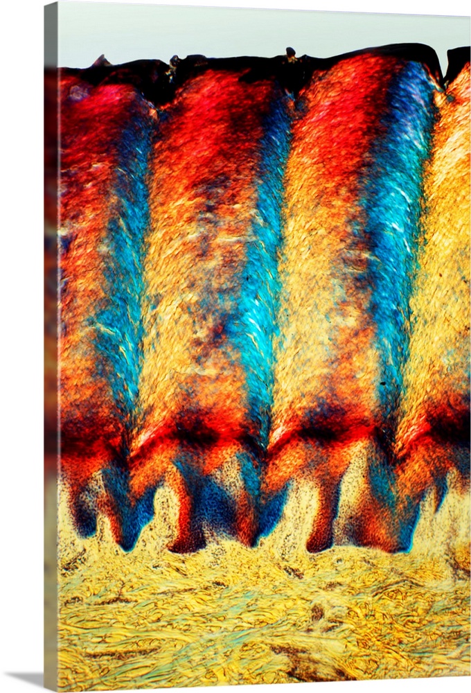 Heel skin tissue. Polarised light micrograph of a transverse section through skin from the heel of a human foot. The sole ...