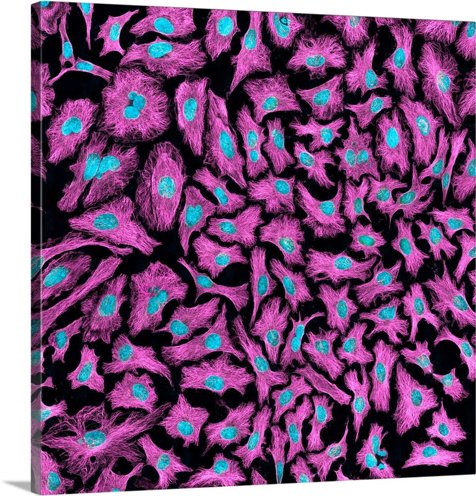 HeLa cells. Multi-photon fluorescence light micrograph of a group of cultured HeLa cells, showing the cell nuclei, which c...