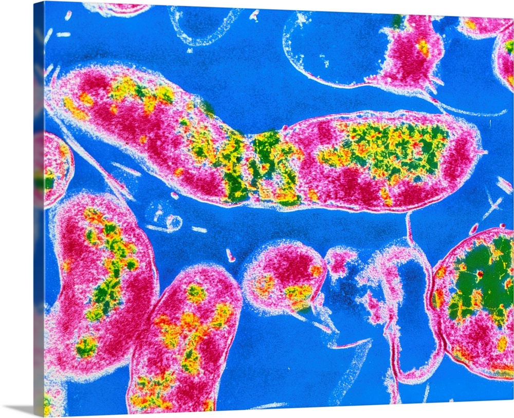 False-colour transmission electron micrograph (TEM) of a group of the bacteria Helicobacter pylori (formerly called Campyl...