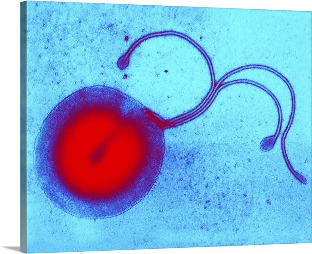 Helicobacter pylori bacterium, coloured transmission electron micrograph (TEM). This section through the bacterium shows a...
