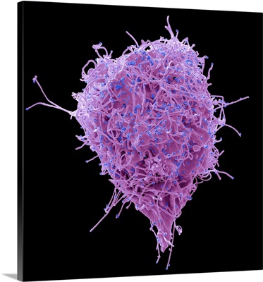 HIV Infected Cell, SEM