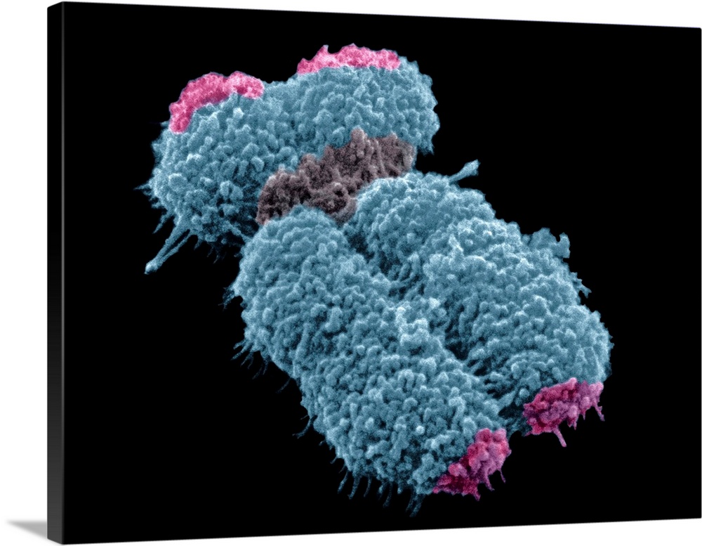 Human chromosome. Coloured scanning electron micrograph (SEM) of a human chromosome. Chromosomes are a packaged form of a ...