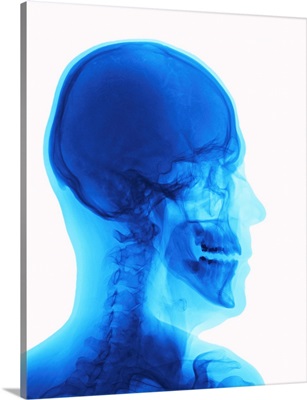Human Head, X-Ray