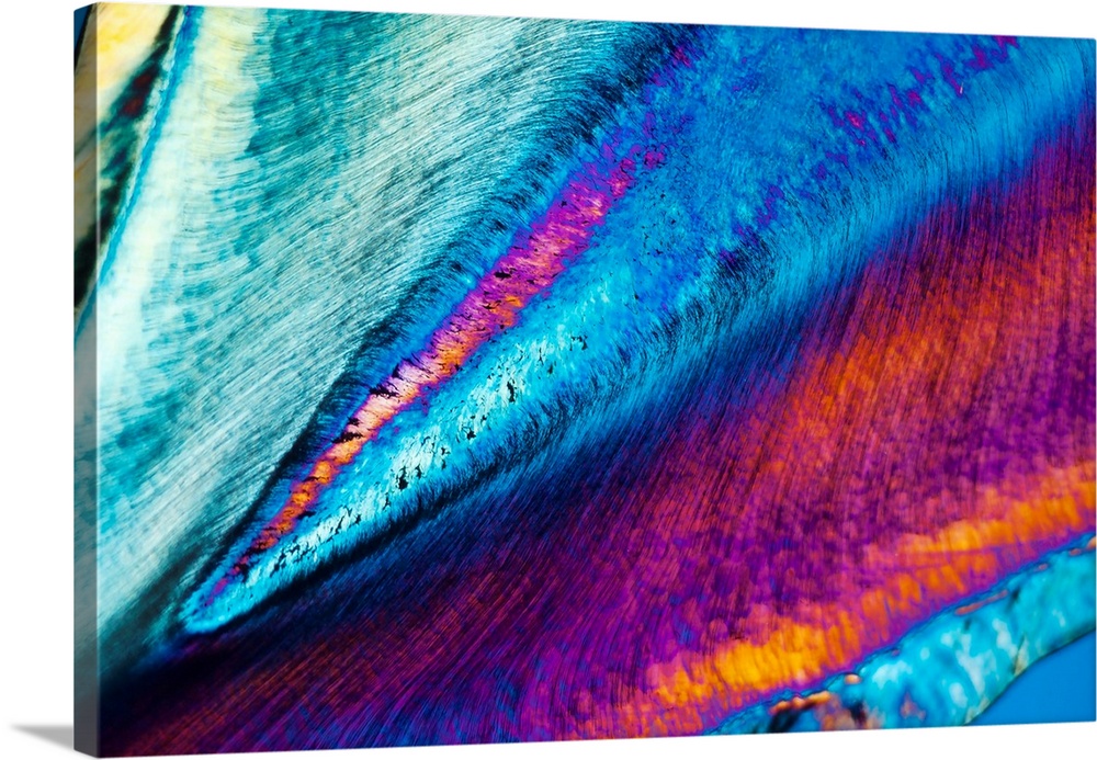 Polarised light microscopy of section of human tooth showing central pulp area, dentine layer and part of the enamel layer.