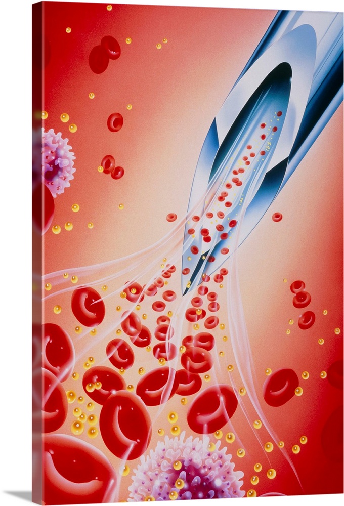 Illustration of a syringe needle sampling blood products, including the low-density lipoprotein (LDL) particle, a form of ...