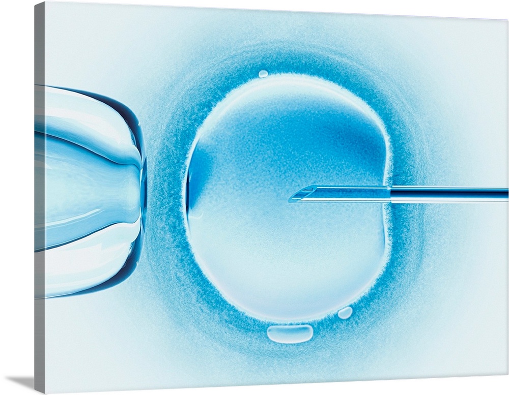 In vitro fertilisation, computer artwork.