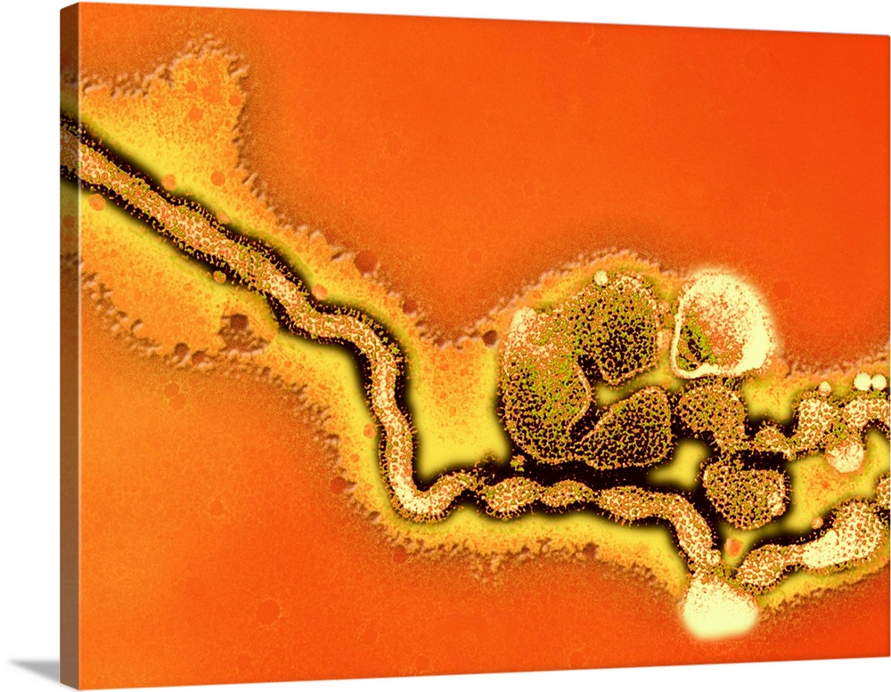 Influenza C virus. Coloured transmission electron micrograph (TEM) of the influenza C virus, which is one of the causes of...