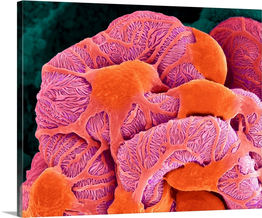 Coloured scanning electron micrograph (SEM) of a kidney glomerulus (podocytes and capillaries of the renal corpuscle). The...