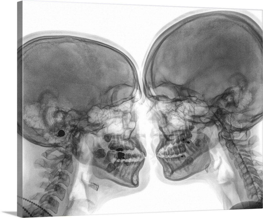 Kissing Couple. Two people kissing under x-ray