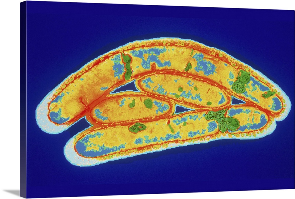 Legionella bacteria. Coloured Transmission Elec- tron micrograph (TEM) of the bacteria Legionella pneumophila, cause of Le...