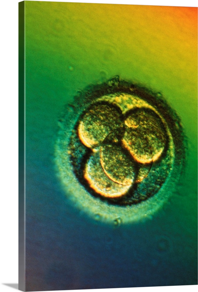 Four-cell embryo. Light micrograph of the blasto- meres of a four-cell human embryo, two days after fertilisation. The bla...