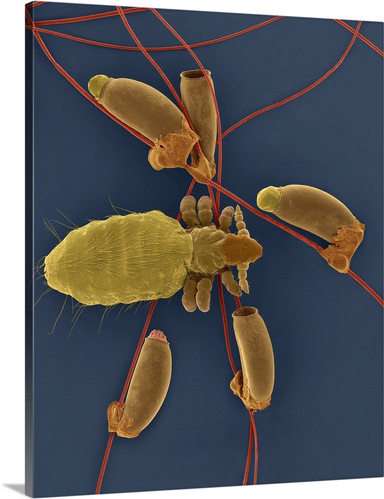Coloured scanning electron micrograph (SEM) of Long-nosed cattle louse (Linognathus vituli) and egg cases with emerging la...