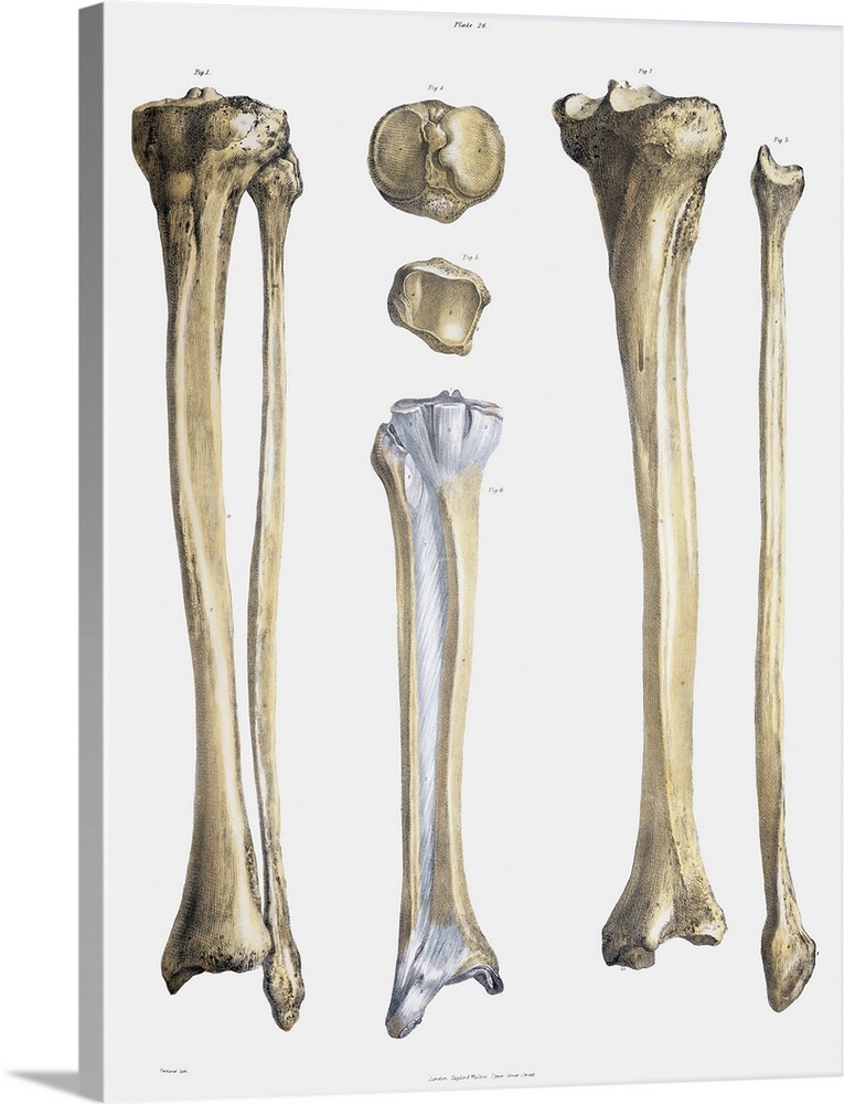 Lower leg bones and ligaments. Historical anatomical artwork of lower leg bones (yellow) and ligaments (pale blue). Ligame...