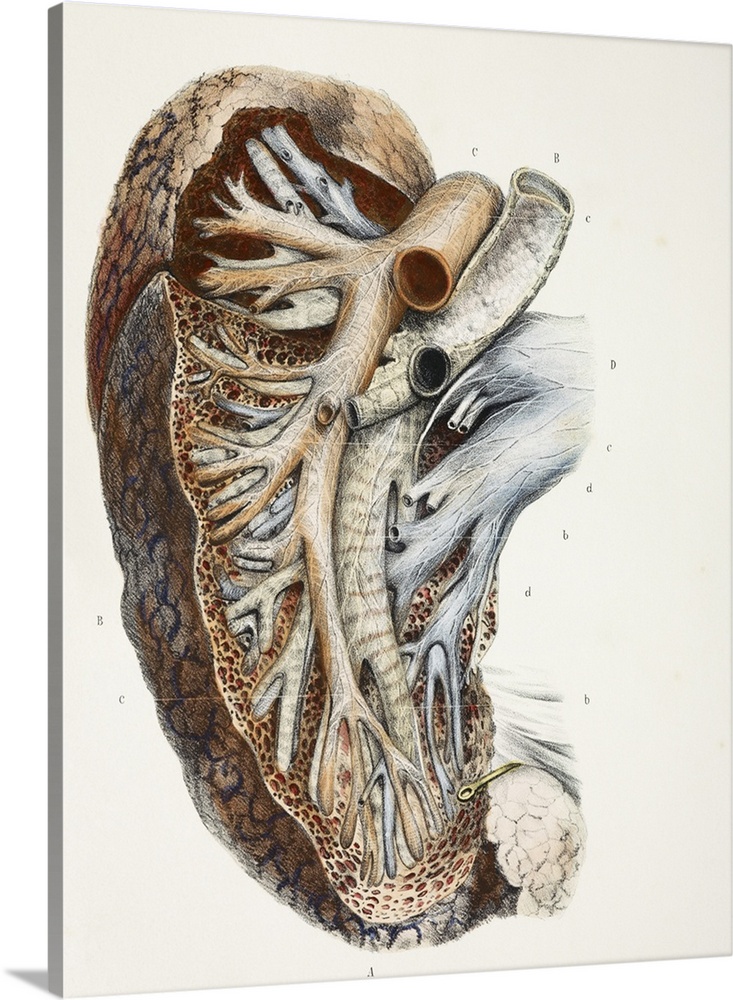 Lung blood vessel nerves. This anatomical artwork is figure 4, plate 96 from volume 3 (1844) of 'Traite complet de l'anato...