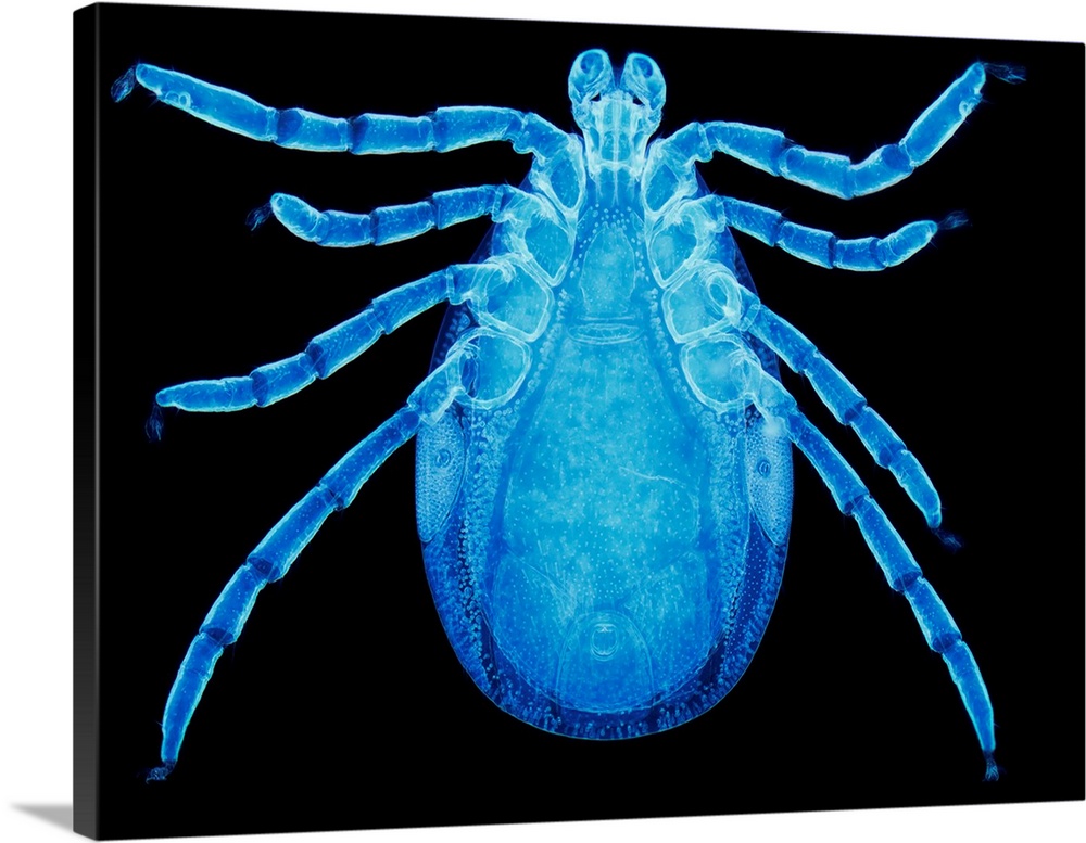 Male Lyme disease tick. Light micrograph (LM) of an Ixodes ricinus tick, the principal vector of Lyme disease in Europe. A...