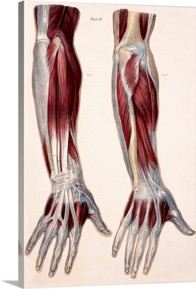 Muscles of the forearm, historical artwork. The figure at left shows the first layer of muscles (red) on the back of the f...