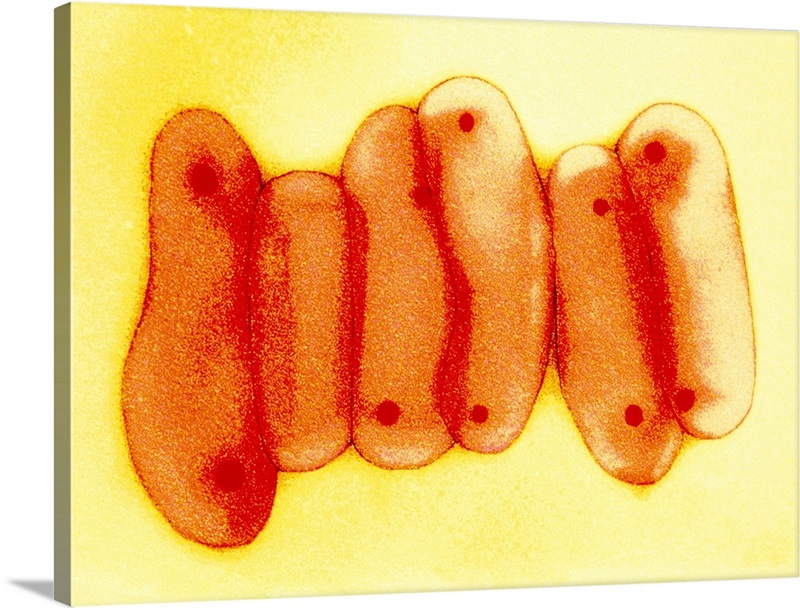 Mycobacterium tuberculosis bacteria Wall Art, Canvas Prints, Framed