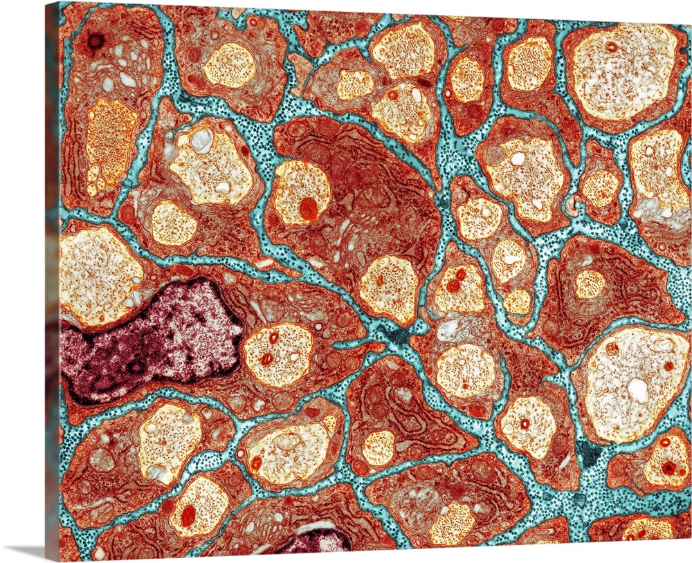 Myelination of nerve fibres. Coloured transmission electron micrograph (TEM) of Schwann cells (orange, with red nuclei) in...